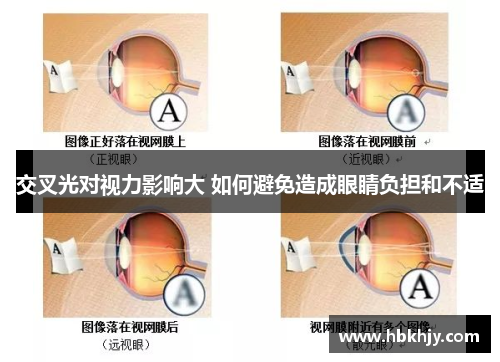 交叉光对视力影响大 如何避免造成眼睛负担和不适